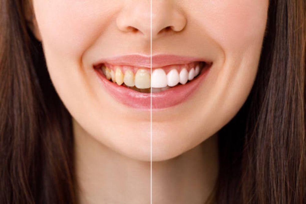 Before & After