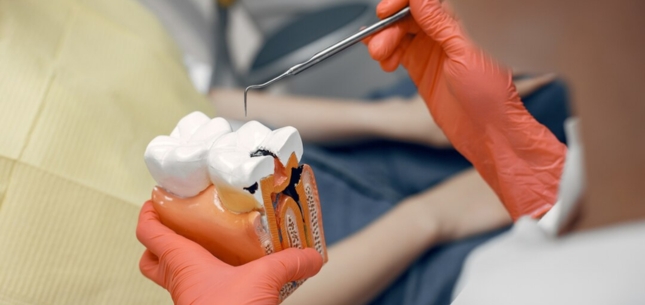 Are Root Canals Part of Endodontics? Saving Teeth With Expert Care
